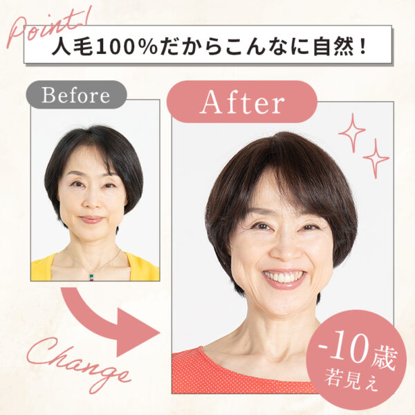 分け目・前髪用部分ウィッグ(かつら)『Pat・pon（パット・ポン ）』 - 画像 (8)